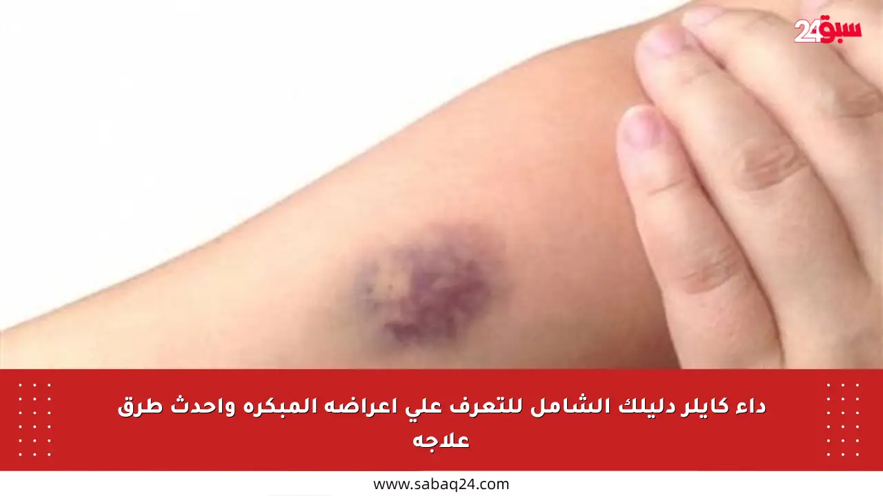 داء كايلر دليلك الشامل للتعرف على أعراضه المبكرة وأحدث طرق علاجه
